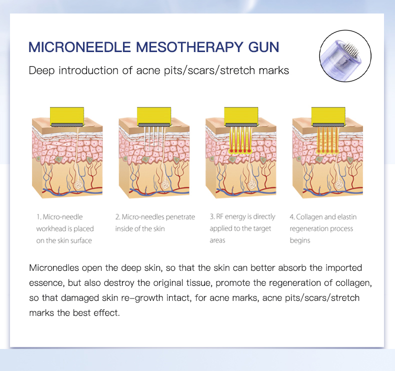 N Meso Lay R Ree Firmosa nano needle free mesotherapy meso gun - Firmosa